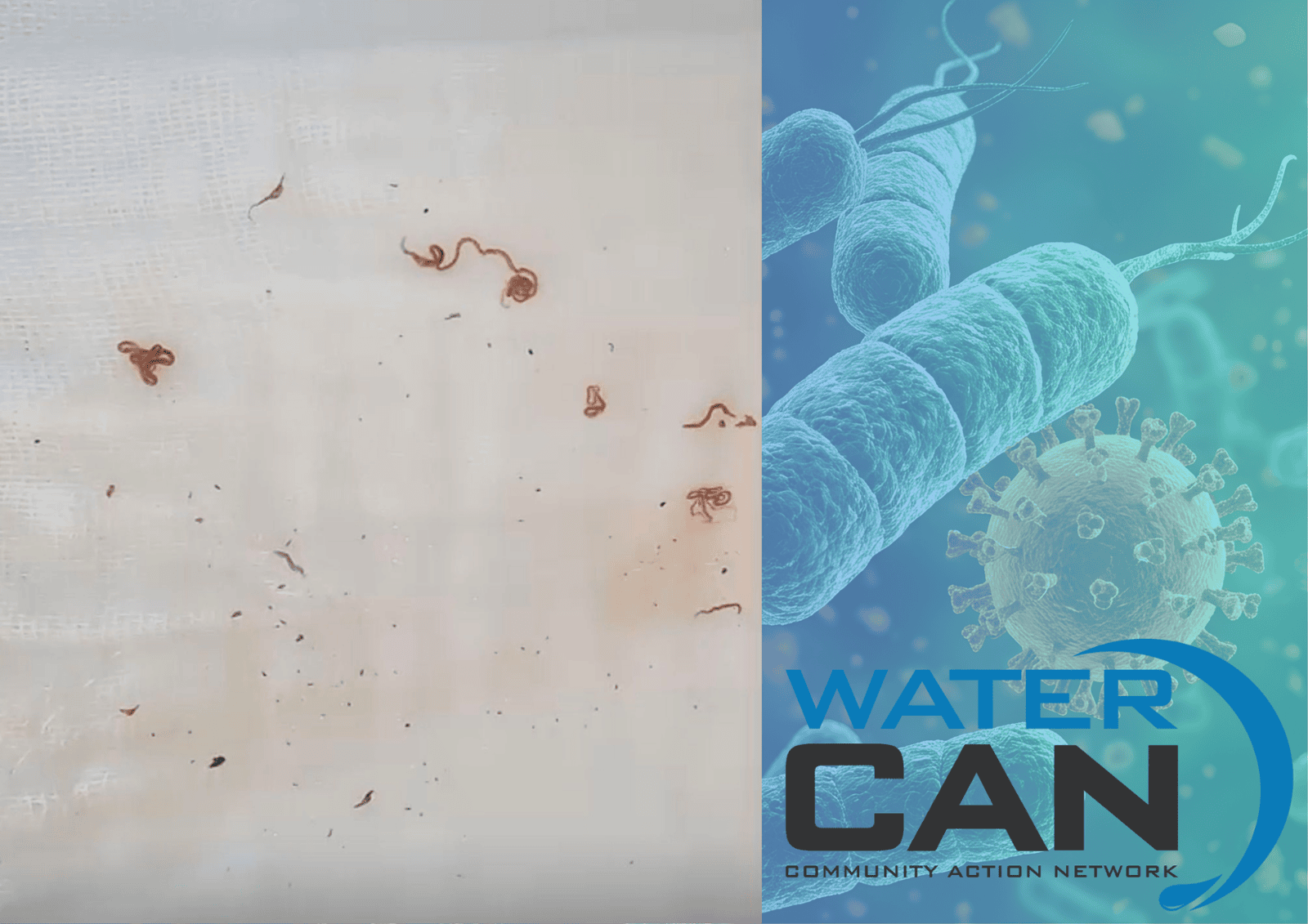 BLOODWORMS IN TAP WATER: Marakong Village, QwaQwa residents fall ill as community left without water